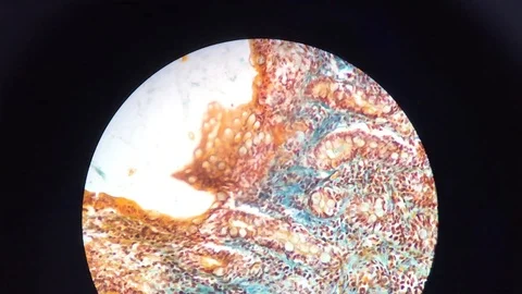 Intestsine under microscope Stock Footage