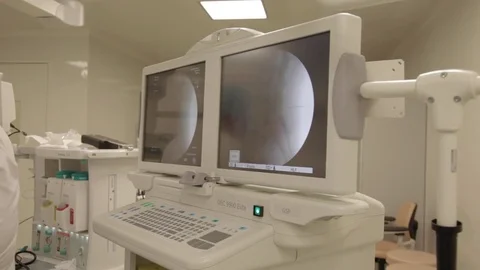 Intraoperative x-ray system c-arm Stock Footage 80147256