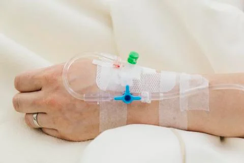 Intravenous drip Foto stock