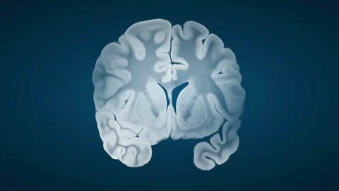 Intricate Human Brain Cross-Section Animated Medical Science Stock Footage 332636674