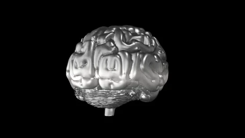 Intricate Silver Brain Model on Black Background Epitomizing Complexity and.. 库存影片 339203309