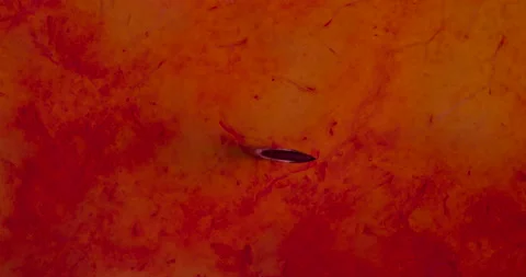Introduction of Injection Intramuscularly 4K Stock-Footage 95161566