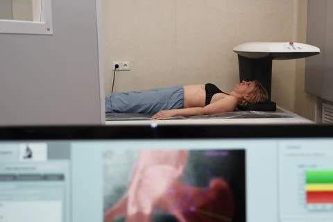 Investigation of the density of human bones using an osteodensitometry appara Foto stock