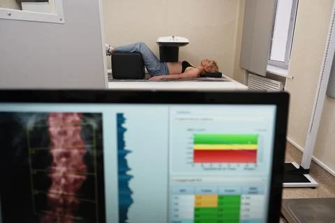 Investigation of the density of human bones using an osteodensitometry apparatus Stock Photos