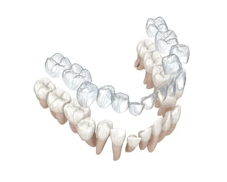 Invisalign braces or invisible retainer make bite correction. Medically accur Stock Illustration
