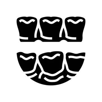 Invisalign treatment glyph icon vector illustration Stock Illustration