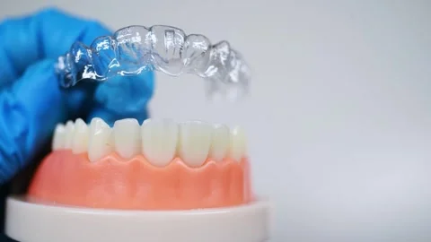 Invisible and removable aligners for teeth alignment Stock Footage 304363932