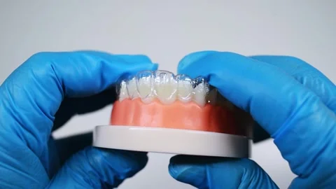 Invisible and removable aligners for teeth alignment Stock Footage 304363938