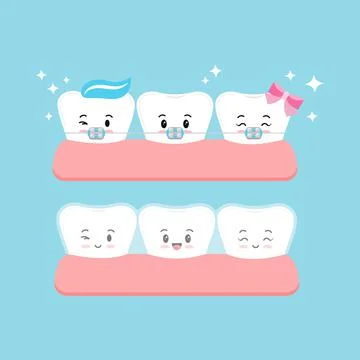 Invisible braces and brackets on tooth set. Stock Illustration
