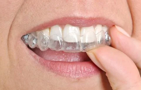 Invisible braces Stock Photos