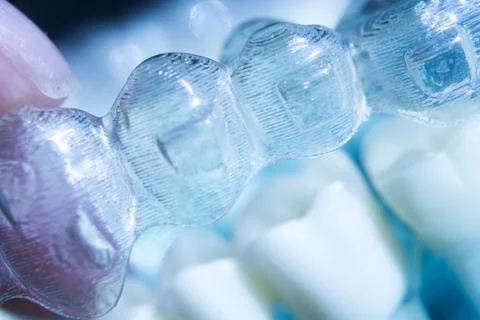 Invisible bracket aligners Stock Photos