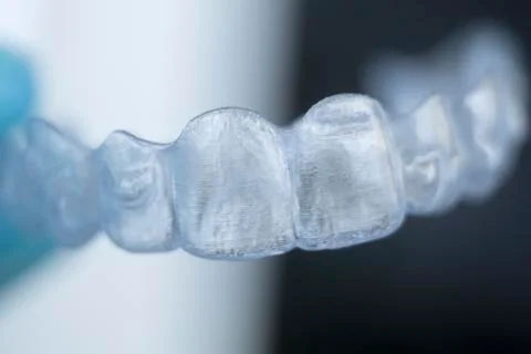 Invisible bracket teeth aligners Stock Photos