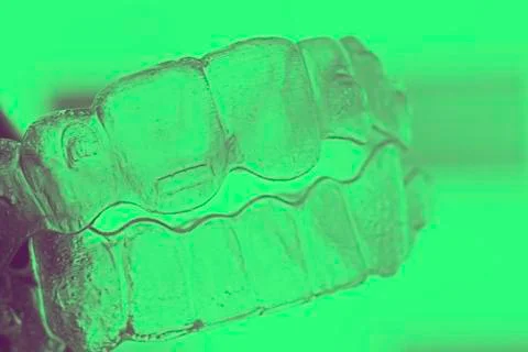 Invisible bracket teeth aligners Stock Photos