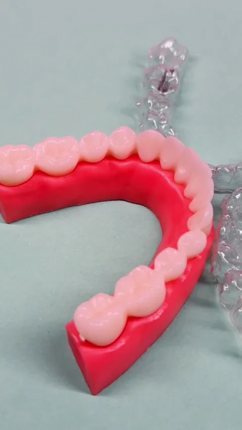 Invisible dental teeth brackets tooth aligners on blue background. Plastic .. Stock Footage 318591722