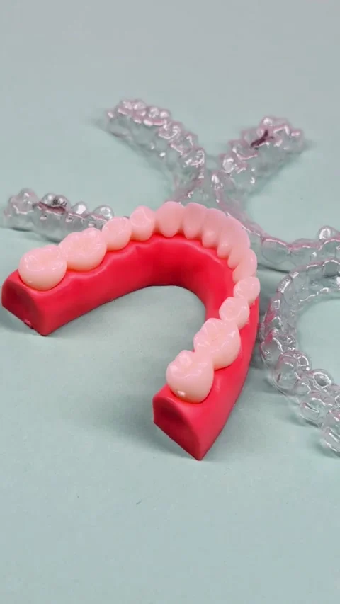 Invisible dental teeth brackets tooth aligners on blue background. Plastic .. Stock Footage 318591723