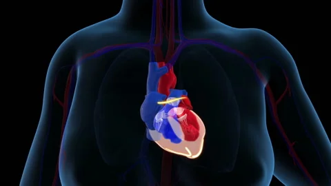 Irregular heartbeat (arrythmia) and atrial fibrillation of a human heart Stock Footage