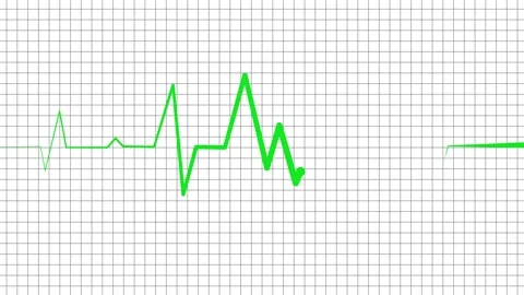 Irregular heartbeat line flat start and end, showing a medical ecg pattern .. Stock Footage 336905327
