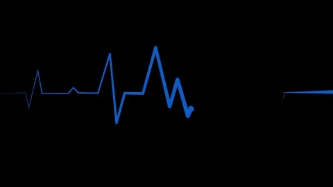 Irregular heartbeat line flat start and end, showing a medical ecg pattern .. Stock Footage 336905339