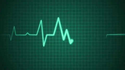 Irregular heartbeat line flat start and end, showing a medical ecg pattern .. Stock Footage 336905350