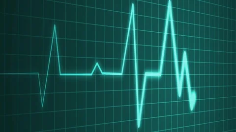 Irregular heartbeat line flat start and end, showing a medical ecg pattern .. Stock Footage 336905385