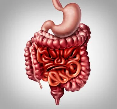 Irritable Bowel Syndrome 库存插图