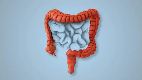 Irritable Bowel Triggers Causing Pain and Bloating Stock Illustration
