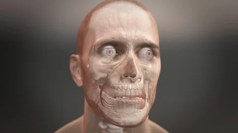 Ischemic Stroke 動画素材 124982604