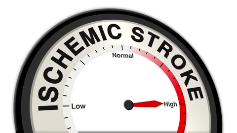 Ischemic stroke Text or Word Level Low Normal High - Barometer or Tachometer Stock Footage 308585853