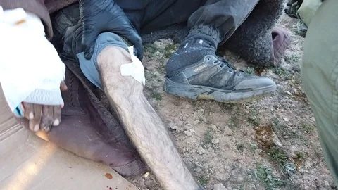 ISIS maimed victim cared by doctors 1 Stock Footage 104919848