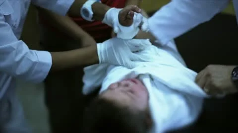 Isolate the wound to start the medical procedure Stock Footage 22248237