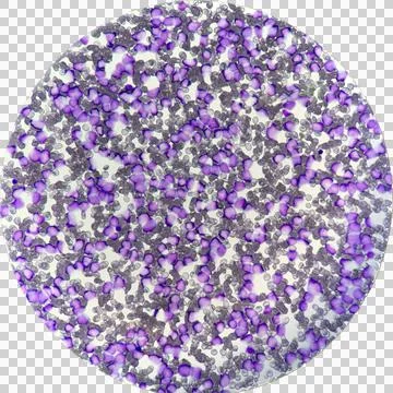 Isolated cutout of microscope view of leukemia Foto stock