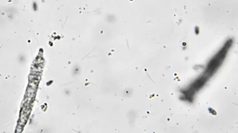 Isolated footage of worm moving in drop of water and hunting for microorganisms Stock Footage 243607604