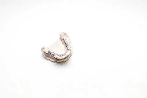 Isolated Metal Frame Lower Partial Denture On Die Stone, Plaster Cast Mold Of Stock Photos