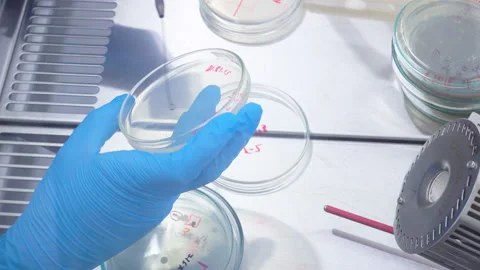 Isolation of bacteria Stock Footage 100184003