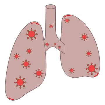 Isometric Infected Human Lungs Vector Icon with Virus Particles Stock-Illustration