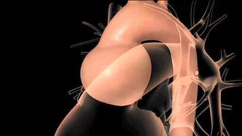 It may affect the left ventricle, aorta, aortic valve, or mitral valve. Stock Illustration