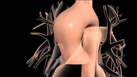 It may affect the left ventricle, aorta, aortic valve, or mitral valve. Stock Illustration