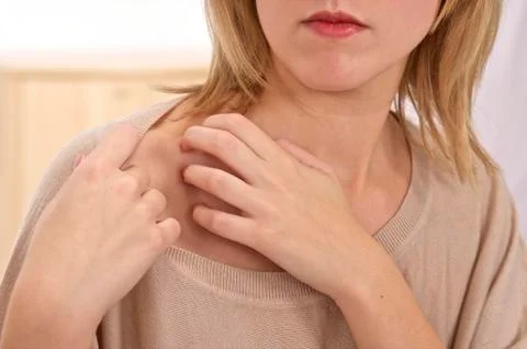 Itching in an adolescent Stock Photos