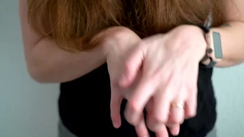 Itching close-up. Scratch your hand. The girl scratches her hand  Stock Footage 146076073