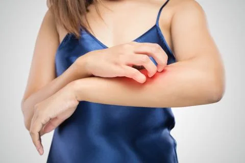 Itching Stock Photos