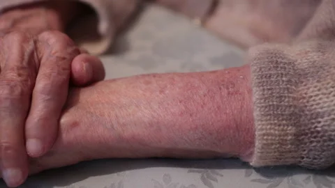 Itching skin Stock Footage 135449014