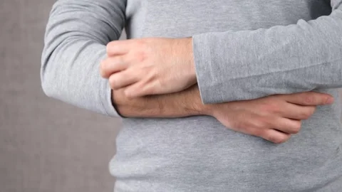 Itching skin Stock Footage 264585980