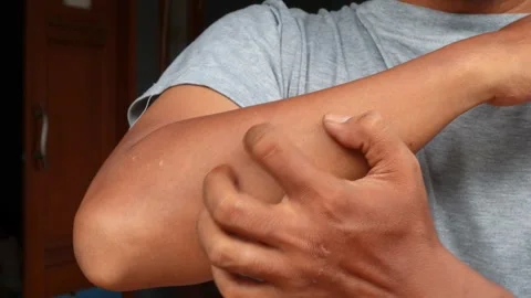 Itchy Video stock 332527981