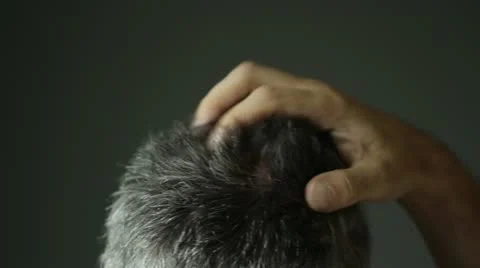 Itchy Scalp Stock Footage 22780824