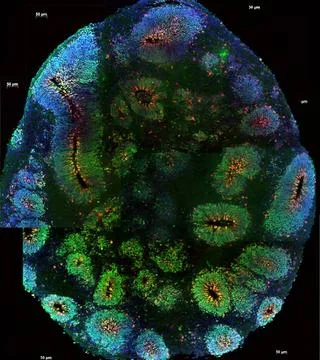  It?s one thing to detect sites in the genome associated with mental disor... Stock Photos