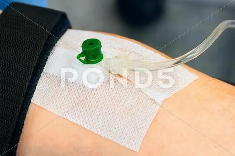 Iv drip with cannula Stock Photos
