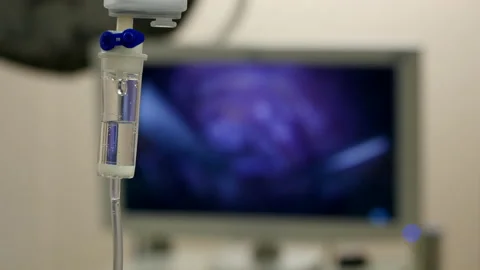 Iv drip, focus moves to screen laparoscopic surgery to remove uterine fibroid Stock Footage 111723509