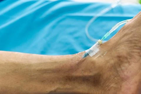 IV Drip Needle Inserted in Patient Ankle Stock Photos