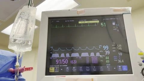 IV drip ventilator vitals Video stock 164046854