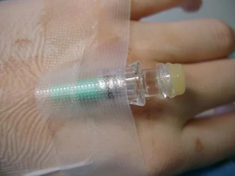 Iv in hand Foto stock